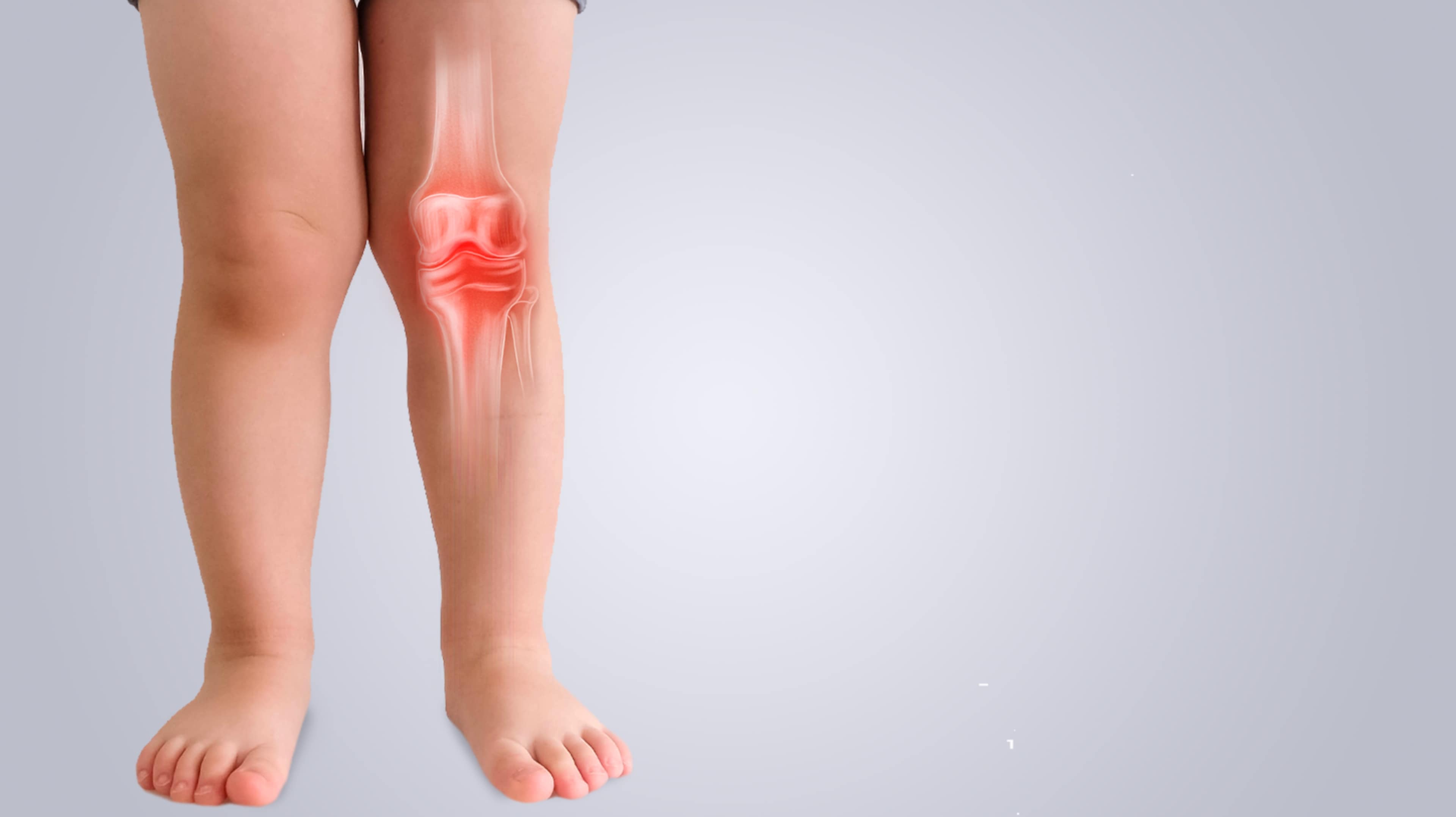 Jambes d'un enfant avec articulation du genou inflammée